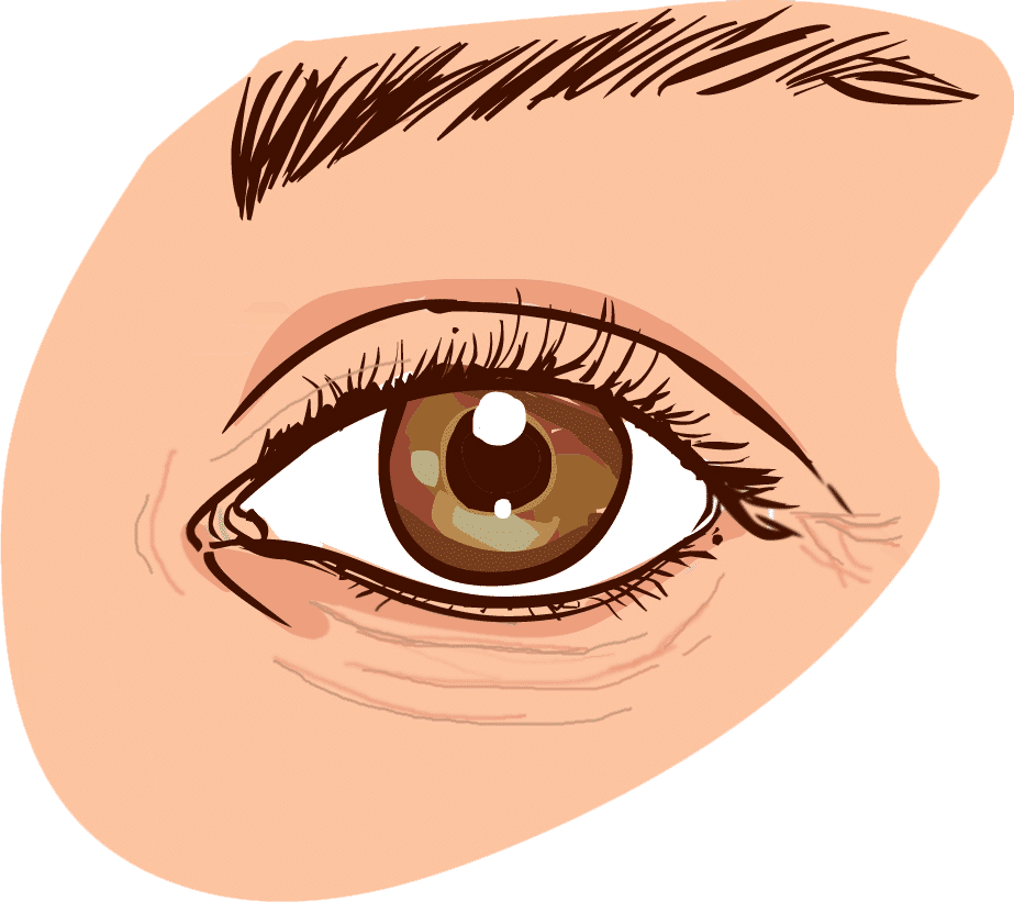 eye-wrinkles